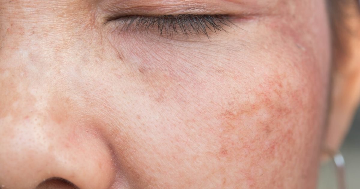 Professionelle Kosmetik kaufen: Beauty of Joseon für makellose Haut